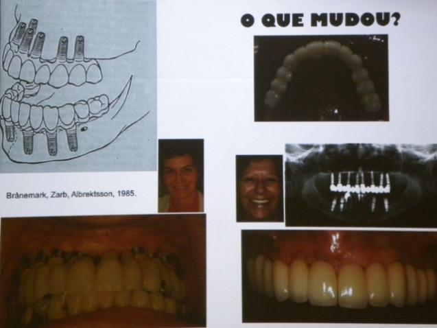 FOTOS_ODONTOLOGIA_IMPLANTODONTIA_290710.JPG_(14C)_640x480(1).jpg