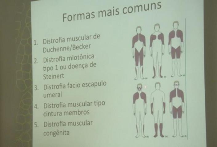 bahiana-distrofias-musculares-discussao-16-07-16-11-jpg